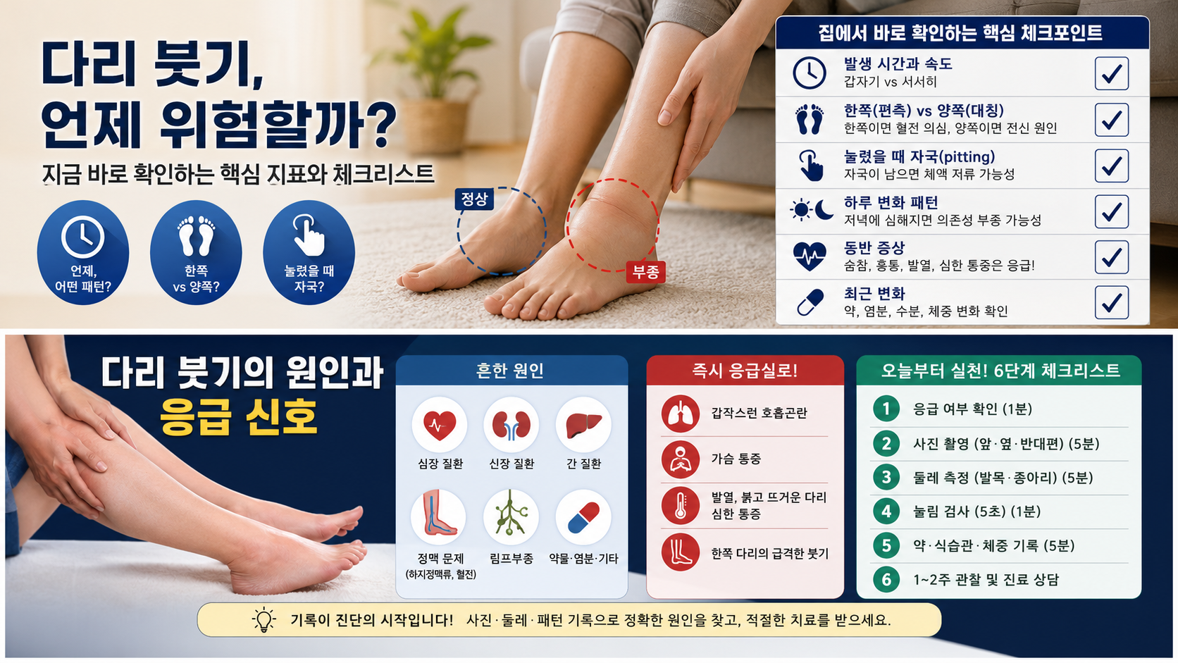 부종·다리 붓기 최신 흐름을 볼 때 확인할 지표과 결과 해석·재검사 상담 기준 관련 이미지